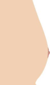 1= شكل صدر مسطح